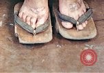 Standbild männlicher Patient Nagasaki Japan, 1946, aus Sekunde 54 historischem Filmmaterial Videoclip 65675060757