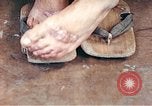 Standbild männlicher Patient Nagasaki Japan, 1946, aus Sekunde 56 historischem Filmmaterial Videoclip 65675060757