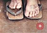 Standbild männlicher Patient Nagasaki Japan, 1946, aus Sekunde 57 historischem Filmmaterial Videoclip 65675060757