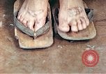 Standbild männlicher Patient Nagasaki Japan, 1946, aus Sekunde 61 historischem Filmmaterial Videoclip 65675060757