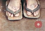 Standbild männlicher Patient Nagasaki Japan, 1946, aus Sekunde 62 historischem Filmmaterial Videoclip 65675060757