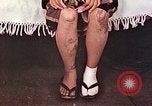 Image of Japanese female patients Nagasaki Japan, 1946, second 24 stock footage video 65675060758