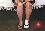 Image of Japanese female patients Nagasaki Japan, 1946, second 27 stock footage video 65675060758