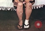 Image of Japanese female patients Nagasaki Japan, 1946, second 36 stock footage video 65675060758