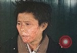 Image of Japanese female patients Nagasaki Japan, 1946, second 48 stock footage video 65675060758