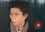 Image of Japanese female patients Nagasaki Japan, 1946, second 51 stock footage video 65675060758