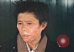 Image of Japanese female patients Nagasaki Japan, 1946, second 52 stock footage video 65675060758