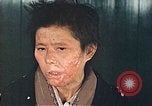 Image of Japanese female patients Nagasaki Japan, 1946, second 53 stock footage video 65675060758
