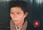Image of Japanese female patients Nagasaki Japan, 1946, second 54 stock footage video 65675060758