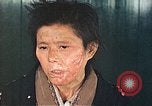 Image of Japanese female patients Nagasaki Japan, 1946, second 55 stock footage video 65675060758