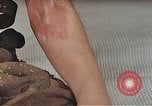 Image of Japanese male patients Nagasaki Japan, 1946, second 21 stock footage video 65675060759