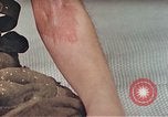 Image of Japanese male patients Nagasaki Japan, 1946, second 23 stock footage video 65675060759
