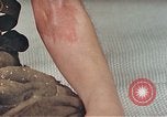 Image of Japanese male patients Nagasaki Japan, 1946, second 25 stock footage video 65675060759