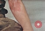 Image of Japanese male patients Nagasaki Japan, 1946, second 26 stock footage video 65675060759