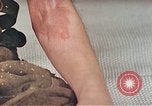 Image of Japanese male patients Nagasaki Japan, 1946, second 27 stock footage video 65675060759