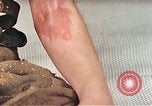 Image of Japanese male patients Nagasaki Japan, 1946, second 37 stock footage video 65675060759