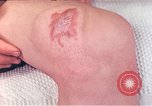 Image of Japanese male patients Nagasaki Japan, 1946, second 38 stock footage video 65675060759