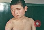 Image of Japanese male patients Nagasaki Japan, 1946, second 61 stock footage video 65675060759