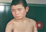 Image of Japanese male patients Nagasaki Japan, 1946, second 62 stock footage video 65675060759
