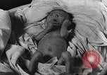 Image of war victims Europe, 1946, second 51 stock footage video 65675063149
