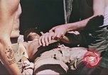 Standbild Verwundetentransport aus dem Koreakrieg Korea, 1950, aus Sekunde 32 historischem Filmmaterial Videoclip 65675065188