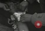 Image blessés de l'équipe de combat régimentaire 442traitées Belmont France, 1944, de la seconde 32 séquences d'archives historiques vidéo 65675065595