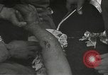 Image blessés de l'équipe de combat régimentaire 442traitées Belmont France, 1944, de la seconde 36 séquences d'archives historiques vidéo 65675065595