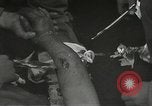 Image blessés de l'équipe de combat régimentaire 442traitées Belmont France, 1944, de la seconde 37 séquences d'archives historiques vidéo 65675065595