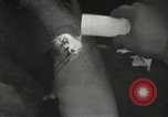 Image blessés de l'équipe de combat régimentaire 442traitées Belmont France, 1944, de la seconde 39 séquences d'archives historiques vidéo 65675065595