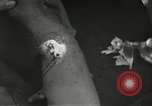 Image blessés de l'équipe de combat régimentaire 442traitées Belmont France, 1944, de la seconde 43 séquences d'archives historiques vidéo 65675065595