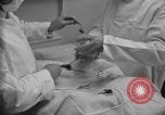 Image of patients treated United States USA, 1956, second 47 stock footage video 65675067770