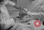 Image of patients treated United States USA, 1956, second 48 stock footage video 65675067770