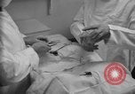 Image of patients treated United States USA, 1956, second 50 stock footage video 65675067770
