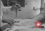 Image of patients treated United States USA, 1956, second 56 stock footage video 65675067770