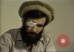Standbild Menschen in Afghanistan verwundet in der sowjetischen Besetzung Washington DC USA, 1984, aus Sekunde 57 historischem Filmmaterial Videoclip 65675068149