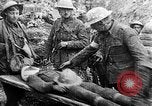 Image of Canadian troops Western Front European Theater, 1915, second 22 stock footage video 65675068361
