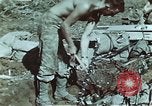 Standbild verwundete Soldaten Pacific Theater, 1945, aus Sekunde 21 historischem Filmmaterial Videoclip 65675068434