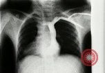 Standbild weltweit erste motion picture X-Ray Italien, 1953, aus Sekunde 19 historischem Filmmaterial Videoclip 65675069098