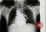 Standbild weltweit erste motion picture X-Ray Italien, 1953, aus Sekunde 20 historischem Filmmaterial Videoclip 65675069098