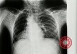 Standbild weltweit erste motion picture X-Ray Italien, 1953, aus Sekunde 21 historischem Filmmaterial Videoclip 65675069098