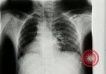 Standbild weltweit erste motion picture X-Ray Italien, 1953, aus Sekunde 22 historischem Filmmaterial Videoclip 65675069098