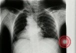 Standbild weltweit erste motion picture X-Ray Italien, 1953, aus Sekunde 23 historischem Filmmaterial Videoclip 65675069098