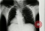 Standbild weltweit erste motion picture X-Ray Italien, 1953, aus Sekunde 24 historischem Filmmaterial Videoclip 65675069098