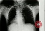 Standbild weltweit erste motion picture X-Ray Italien, 1953, aus Sekunde 25 historischem Filmmaterial Videoclip 65675069098