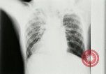 Standbild weltweit erste motion picture X-Ray Italien, 1953, aus Sekunde 26 historischem Filmmaterial Videoclip 65675069098