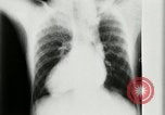 Standbild weltweit erste motion picture X-Ray Italien, 1953, aus Sekunde 27 historischem Filmmaterial Videoclip 65675069098