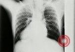 Standbild weltweit erste motion picture X-Ray Italien, 1953, aus Sekunde 28 historischem Filmmaterial Videoclip 65675069098