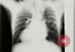 Standbild weltweit erste motion picture X-Ray Italien, 1953, aus Sekunde 29 historischem Filmmaterial Videoclip 65675069098