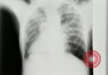 Standbild weltweit erste motion picture X-Ray Italien, 1953, aus Sekunde 30 historischem Filmmaterial Videoclip 65675069098