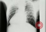 Standbild weltweit erste motion picture X-Ray Italien, 1953, aus Sekunde 31 historischem Filmmaterial Videoclip 65675069098